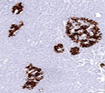 Insulin Antibody - Insulin antibody E2-E3 or INS04 immunohistochemistry pancreas.  This image was taken for the unmodified form of this product. Other forms have not been tested.