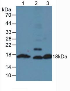 Insulin Antibody - Western Blot; Sample: Lane1: Mouse Pancreas Tissue; Lane2: Mouse Testis Tissue; Lane3: Mouse Liver Tissue.