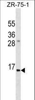 Insulin Antibody - INS Antibody western blot of ZR-75-1 cell line lysates (35 ug/lane). The INS antibody detected the INS protein (arrow).