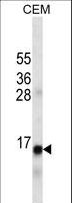 Insulin Antibody - INS Antibody western blot of CEM cell line lysates (35 ug/lane). The INS antibody detected the INS protein (arrow).