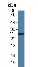 Insulin Antibody