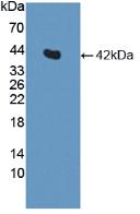 Insulin Antibody