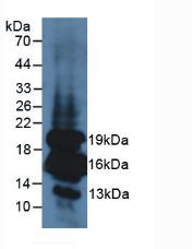 Insulin Antibody