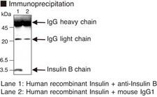 Insulin Antibody
