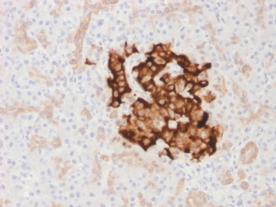 Insulin Antibody - Formalin-paraffin human Pancreas stained with Insulin Rabbit Recombinant Monoclonal Antibody (IRDN/1980R).