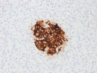 Insulin Antibody - Formalin-fixed, paraffin-embedded human Pancreas stained with Insulin Mouse Recombinant Monoclonal Antibody (rIRDN/805).