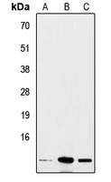 Insulin Antibody - Western blot analysis of Insulin expression in A549 (A); mouse heart (B); rat liver (C) whole cell lysates.