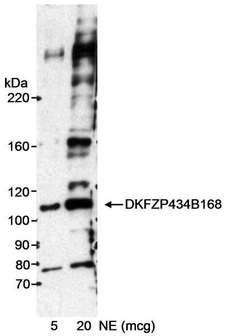 INT7 / INTS7 Antibody - Detection of Human DKFZP434B168 by Western Blot. Sample: Nuclear extract (NE) from HeLa cells. Antibody: Rabbit anti-DKFZP434B168 antibody used at 0.1 ug/ml. Detection: Chemiluminescence with an exposure time of 15 minutes.