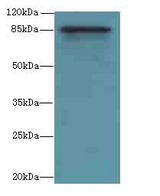 Internalin-A Antibody - Western blot. All lanes: inlA antibody at 10 ug/ml+290- whole cell lysate Goat polyclonal to rabbit at 1:10000 dilution. Predicted band size: 86 kDa. Observed band size: 86 kDa.