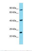INTS10 Antibody - Western blot of Human ACHN. INTS10 antibody dilution 1.0 ug/ml.  This image was taken for the unconjugated form of this product. Other forms have not been tested.