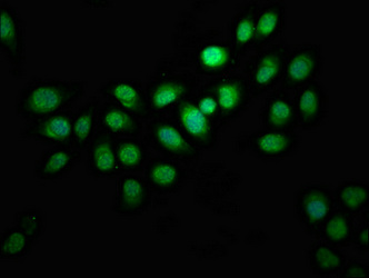 INTS10 Antibody - Immunofluorescence staining of A549 cells at a dilution of 1:133, counter-stained with DAPI. The cells were fixed in 4% formaldehyde, permeabilized using 0.2% Triton X-100 and blocked in 10% normal Goat Serum. The cells were then incubated with the antibody overnight at 4 °C.The secondary antibody was Alexa Fluor 488-congugated AffiniPure Goat Anti-Rabbit IgG (H+L) .