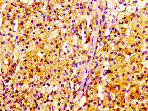 INTS10 Antibody - Immunohistochemistry image at a dilution of 1:100 and staining in paraffin-embedded human adrenal gland tissue performed on a Leica BondTM system. After dewaxing and hydration, antigen retrieval was mediated by high pressure in a citrate buffer (pH 6.0) . Section was blocked with 10% normal goat serum 30min at RT. Then primary antibody (1% BSA) was incubated at 4 °C overnight. The primary is detected by a biotinylated secondary antibody and visualized using an HRP conjugated SP system.
