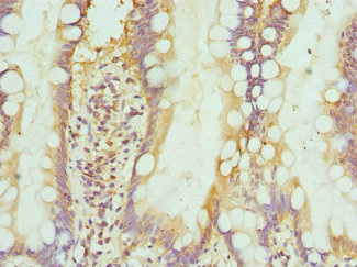 INTS10 Antibody - Immunohistochemistry of paraffin-embedded human small intestine at dilution 1:100