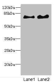 INTS10 Antibody - Western blot All Lanes: INTS10 antibody at 4.35ug/ml Lane 1 : Mouse kidney tissue Lane 2 : Rat gonadal tissue Secondary Goat polyclonal to Rabbit IgG at 1/10000 dilution Predicted band size: 82 kDa Observed band size: 82 kDa
