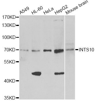 INTS10 Antibody - Western blot analysis of extracts of various cell lines, using INTS10 antibody at 1:1000 dilution. The secondary antibody used was an HRP Goat Anti-Rabbit IgG (H+L) at 1:10000 dilution. Lysates were loaded 25ug per lane and 3% nonfat dry milk in TBST was used for blocking. An ECL Kit was used for detection and the exposure time was 5min.