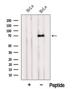 INTS10 Antibody - Western blot analysis of extracts of HeLa cells using INTS10 antibody. The lane on the left was treated with blocking peptide.