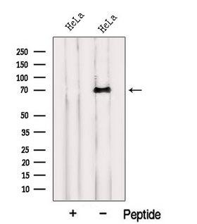 INTS10 Antibody - Western blot analysis of extracts of HeLa cells using INTS10 antibody. The lane on the left was treated with blocking peptide.