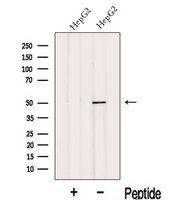 INTS12 Antibody - Western blot analysis of extracts of HepG2 cells using INTS12 antibody. The lane on the left was treated with blocking peptide.