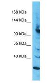 INTS2 / INT2 Antibody - INTS2 / INT2 antibody Western Blot of HepG2. Antibody dilution: 1 ug/ml.  This image was taken for the unconjugated form of this product. Other forms have not been tested.