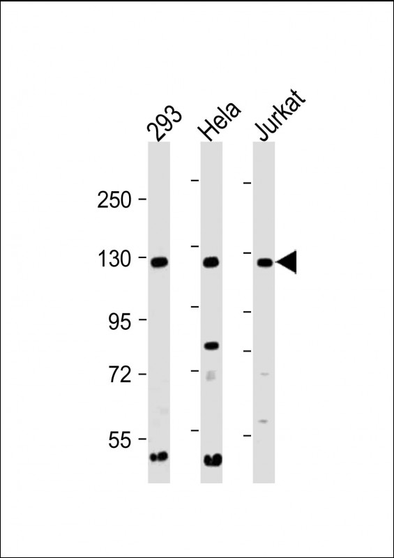INTS3 Antibody - All lanes: Anti-INTS3 Antibody (C-Term) at 1:2000 dilution Lane 1: 293 whole cell lysate Lane 2: Hela whole cell lysate Lane 3: Jurkat whole cell lysate Lysates/proteins at 20 µg per lane. Secondary Goat Anti-Rabbit IgG, (H+L), Peroxidase conjugated at 1/10000 dilution. Predicted band size: 118 kDa Blocking/Dilution buffer: 5% NFDM/TBST.