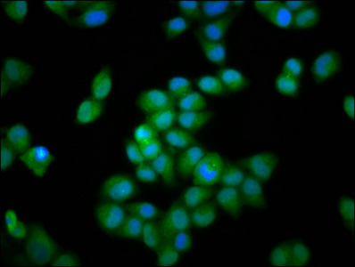 INTS3 Antibody - Immunofluorescence staining of Hela cells diluted at 1:66, counter-stained with DAPI. The cells were fixed in 4% formaldehyde, permeabilized using 0.2% Triton X-100 and blocked in 10% normal Goat Serum. The cells were then incubated with the antibody overnight at 4°C.The Secondary antibody was Alexa Fluor 488-congugated AffiniPure Goat Anti-Rabbit IgG (H+L).