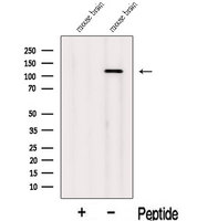 INTS3 Antibody - Western blot analysis of extracts of mouse brain tissue using INTS3 antibody. The lane on the left was treated with blocking peptide.