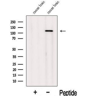 INTS3 Antibody - Western blot analysis of extracts of mouse brain tissue using INTS3 antibody. The lane on the left was treated with blocking peptide.