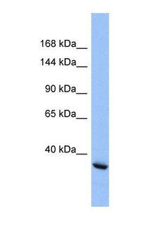 INTS4 Antibody - Western blot of Human HepG2. INTS4 antibody dilution 1.0 ug/ml.  This image was taken for the unconjugated form of this product. Other forms have not been tested.