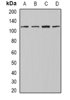 INTS4 Antibody - Western blot analysis of INTS4 expression in Jurkat (A); A549 (B); mouse testis (C); mouse heart (D) whole cell lysates.