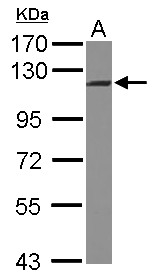 INTS5 Antibody - Sample (30 ug of whole cell lysate) A: U87-MG 7.5% SDS PAGE INTS5 antibody diluted at 1:1000