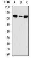 INTS5 Antibody - Western blot analysis of INTS5 expression in MCF7 (A); HT29 (B); mouse liver (C) whole cell lysates.