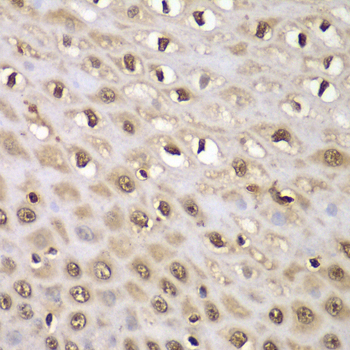 INTS5 Antibody - Immunohistochemistry of paraffin-embedded human esophagus using INTS5 antibody at dilution of 1:100 (40x lens).