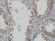 INTS6 Antibody - Immunoperoxidase of monoclonal antibody to DDX26 on formalin-fixed paraffin-embedded human testis. [antibody concentration 3 ug/ml]
