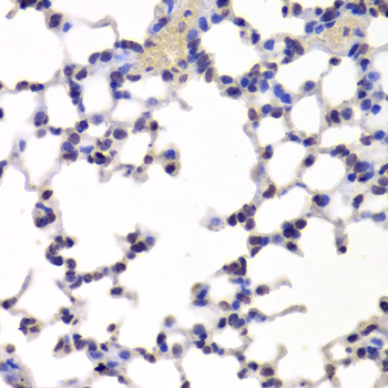 INTS6 Antibody - Immunohistochemistry of paraffin-embedded Mouse lung tissue.