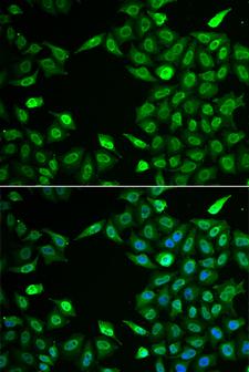 INTS6 Antibody - Immunofluorescence analysis of A549 cells.