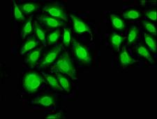 INTS6 Antibody - Immunofluorescence staining of A549 cells at a dilution of 1:33, counter-stained with DAPI. The cells were fixed in 4% formaldehyde, permeabilized using 0.2% Triton X-100 and blocked in 10% normal Goat Serum. The cells were then incubated with the antibody overnight at 4 °C.The secondary antibody was Alexa Fluor 488-congugated AffiniPure Goat Anti-Rabbit IgG (H+L) .