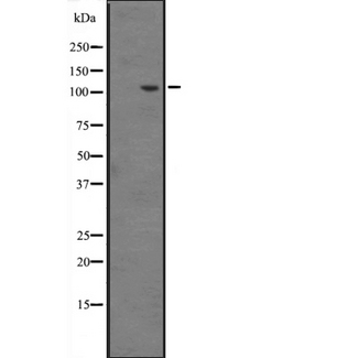 INTS6 Antibody - Western blot analysis of INT6 expression in HeLa cells lysate. The lane on the left is treated with the antigen-specific peptide.