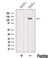 INTS8 Antibody - Western blot analysis of extracts of HeLa cells using INTS8 antibody. The lane on the left was treated with blocking peptide.