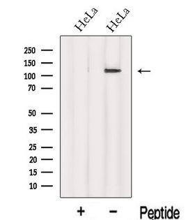 INTS8 Antibody - Western blot analysis of extracts of HeLa cells using INTS8 antibody. The lane on the left was treated with blocking peptide.