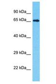 INTS9 Antibody - INTS9 antibody Western Blot of MCF7. Antibody dilution: 1 ug/ml.  This image was taken for the unconjugated form of this product. Other forms have not been tested.