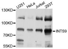 INTS9 Antibody - Western blot analysis of extracts of various cell lines, using INTS9 antibody at 1:1000 dilution. The secondary antibody used was an HRP Goat Anti-Rabbit IgG (H+L) at 1:10000 dilution. Lysates were loaded 25ug per lane and 3% nonfat dry milk in TBST was used for blocking. An ECL Kit was used for detection and the exposure time was 30s.