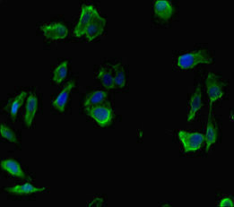 INTS9 Antibody - Immunofluorescent analysis of Hela cells diluted at 1:100 and Alexa Fluor 488-congugated AffiniPure Goat Anti-Rabbit IgG(H+L)