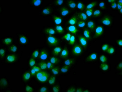 INTU Antibody - Immunofluorescence staining of Hela cells diluted at 1:100, counter-stained with DAPI. The cells were fixed in 4% formaldehyde, permeabilized using 0.2% Triton X-100 and blocked in 10% normal Goat Serum. The cells were then incubated with the antibody overnight at 4°C.The Secondary antibody was Alexa Fluor 488-congugated AffiniPure Goat Anti-Rabbit IgG (H+L).