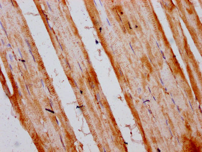 INTU Antibody - Immunohistochemistry Dilution at 1:300 and staining in paraffin-embedded human skeletal muscle tissue performed on a Leica BondTM system. After dewaxing and hydration, antigen retrieval was mediated by high pressure in a citrate buffer (pH 6.0). Section was blocked with 10% normal Goat serum 30min at RT. Then primary antibody (1% BSA) was incubated at 4°C overnight. The primary is detected by a biotinylated Secondary antibody and visualized using an HRP conjugated SP system.
