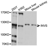 INVS / Inversin Antibody - Western blot analysis of extracts of various cell lines, using INVS antibody at 1:1000 dilution. The secondary antibody used was an HRP Goat Anti-Rabbit IgG (H+L) at 1:10000 dilution. Lysates were loaded 25ug per lane and 3% nonfat dry milk in TBST was used for blocking. An ECL Kit was used for detection and the exposure time was 30s.