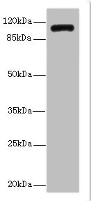 INVS / Inversin Antibody - Western blot All Lanes: INVS antibody IgG at 14ug/ml+ K562 whole cell lysate Secondary Goat polyclonal to rabbit IgG at 1/10000 dilution Predicted band size: 118,100,11 kDa Observed band size: 118 kDa