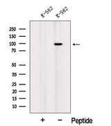 INVS / Inversin Antibody - Western blot analysis of extracts of HeLa cells using INVS antibody. The lane on the left was treated with blocking peptide.