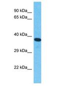 IOP1 / NARFL Antibody - IOP1 / NARFL antibody Western Blot of ACHN. Antibody dilution: 1 ug/ml.  This image was taken for the unconjugated form of this product. Other forms have not been tested.