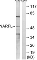 IOP1 / NARFL Antibody - Western blot analysis of lysates from A549 cells, using NARFL Antibody. The lane on the right is blocked with the synthesized peptide.