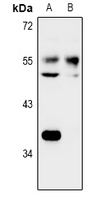 IOP1 / NARFL Antibody - Western blot analysis of NARFL expression in MCF7 (A), H1792 (B) whole cell lysates.
